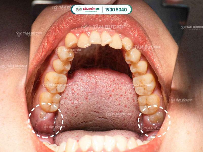 Nha Khoa Tâm Đức Smile