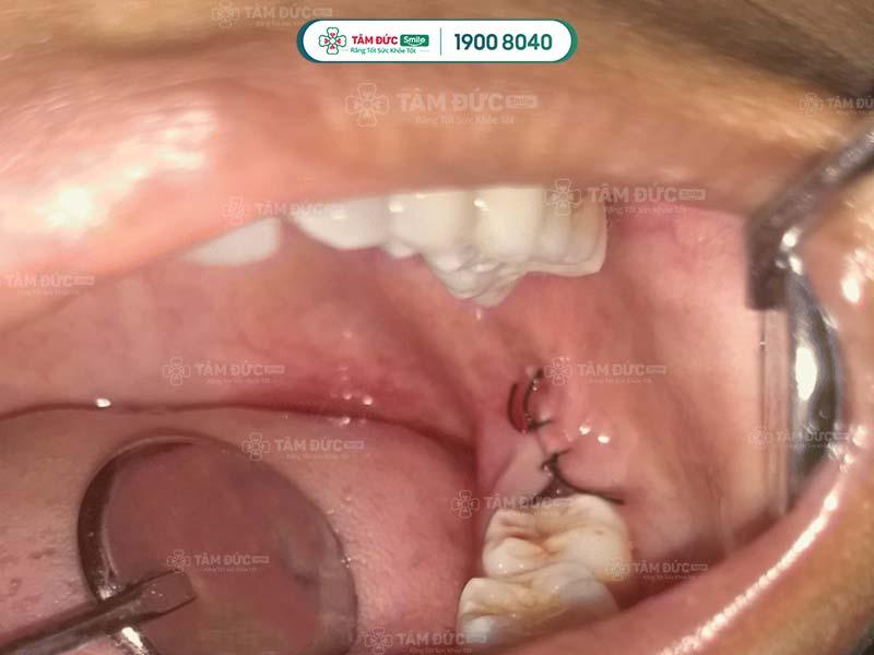 Nha Khoa Tâm Đức Smile