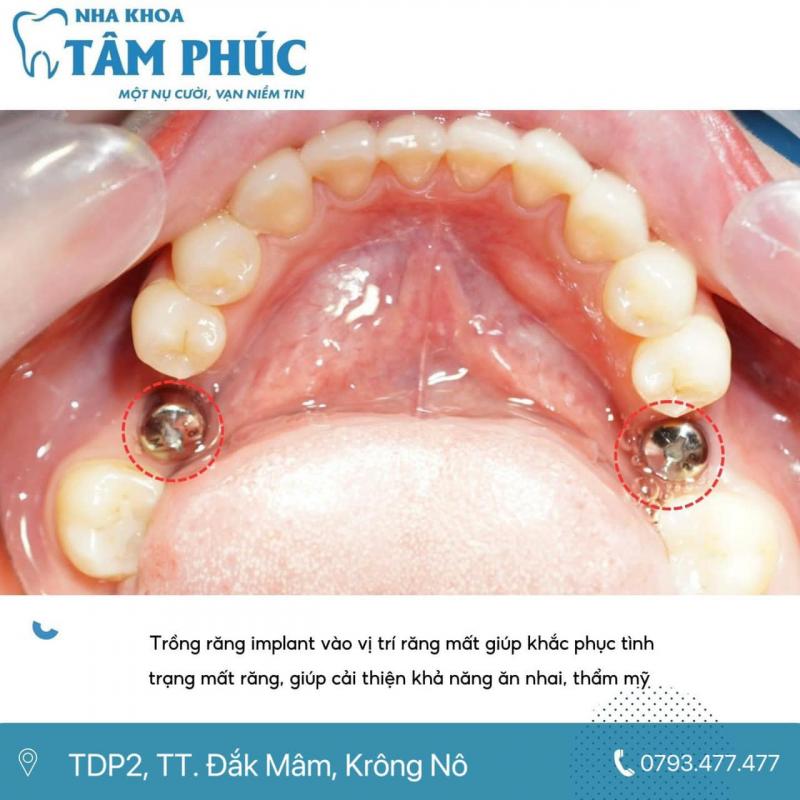 Nha Khoa Tâm Phúc Krông Nô