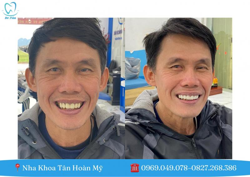 Nha Khoa Tân Hoàn Mỹ - Xuân Mai