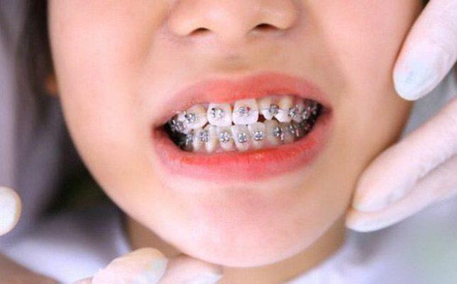 Nha Khoa Thạch Trụ Nụ Cười Xinh