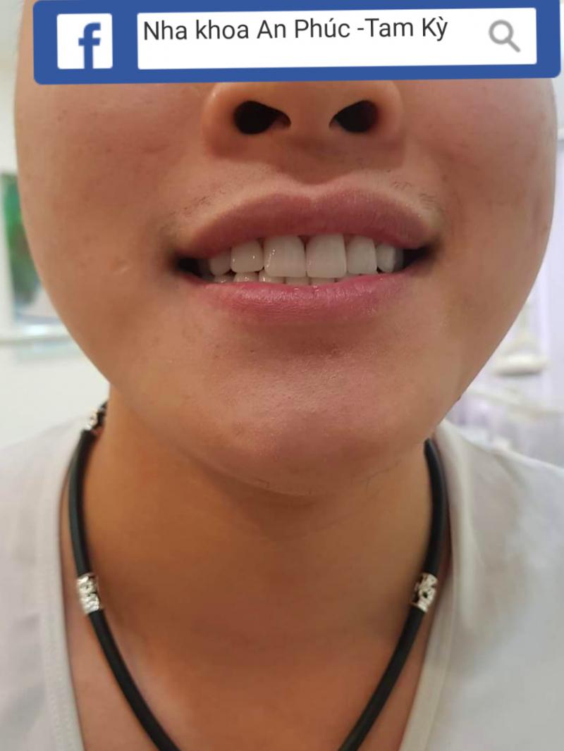 Nha Khoa Thẩm Mỹ An Phúc