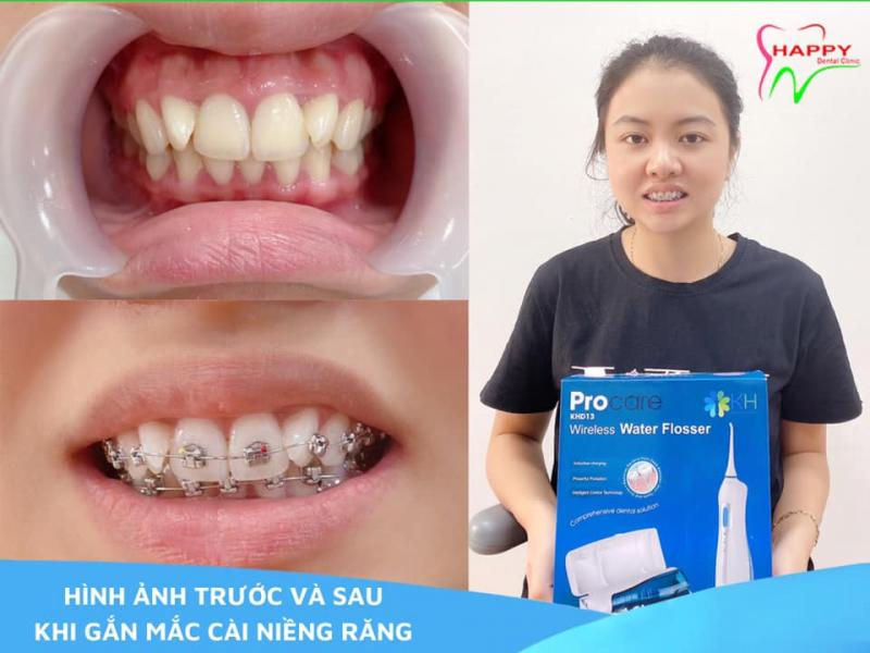 Nha Khoa Thẩm Mỹ Happy