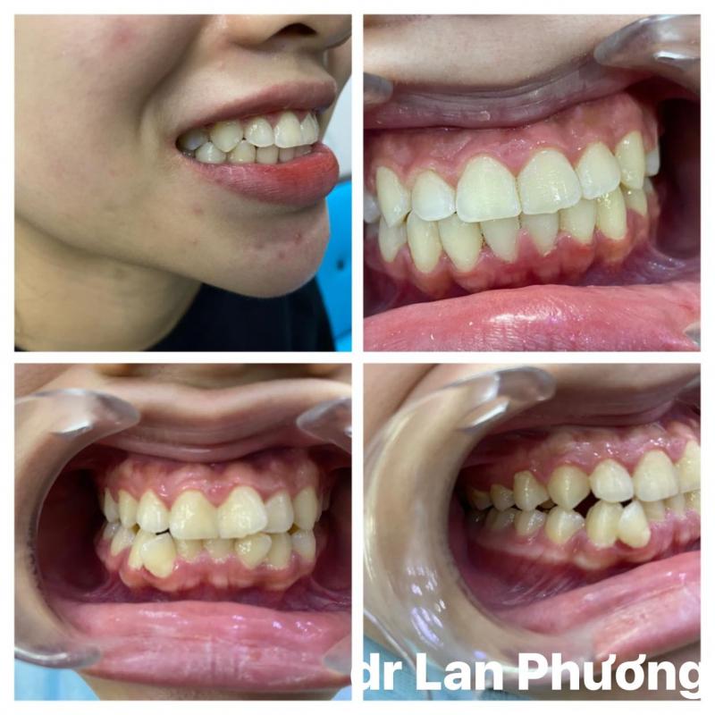 Nha Khoa Thẩm mỹ Lan Phương