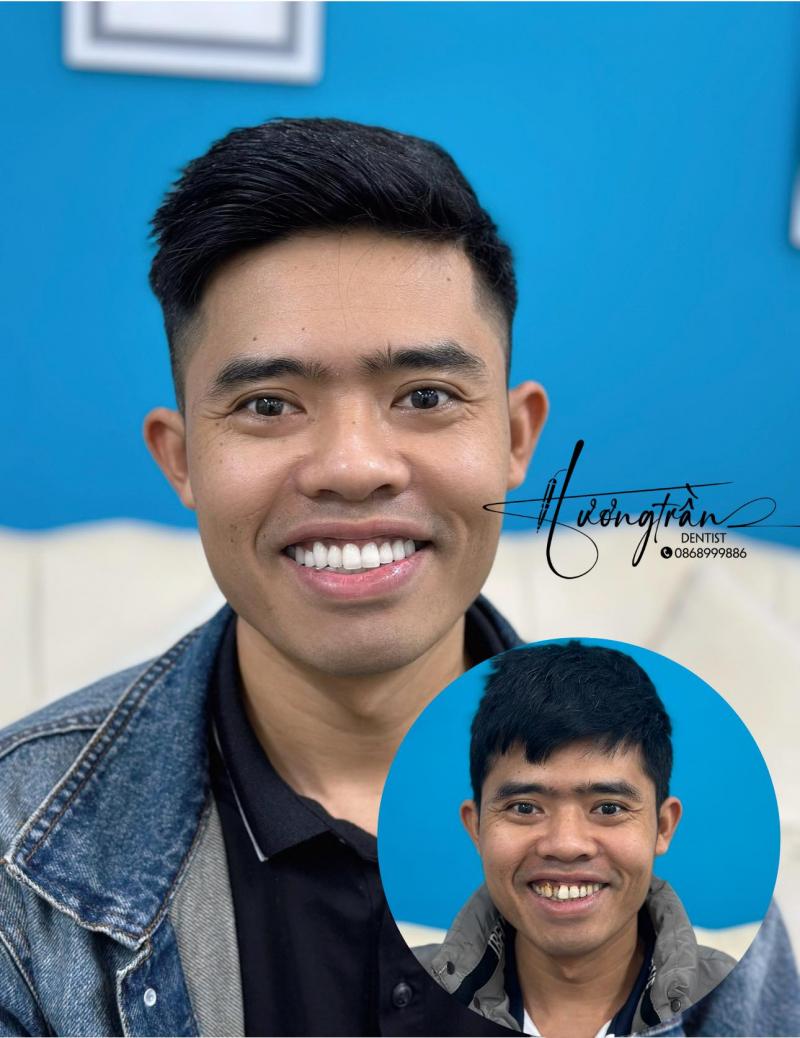 Nha Khoa Thẩm Mỹ Lào Cai - Ann Dental