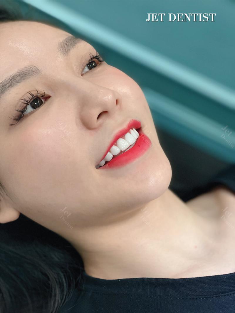 Nha Khoa Thẩm Mỹ Quốc Tế - Jet Dentist