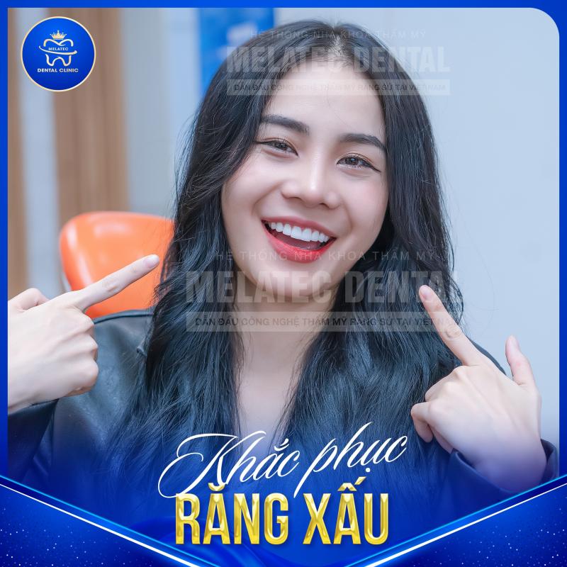 Nha Khoa Thẩm Mỹ Quốc Tế Melatec