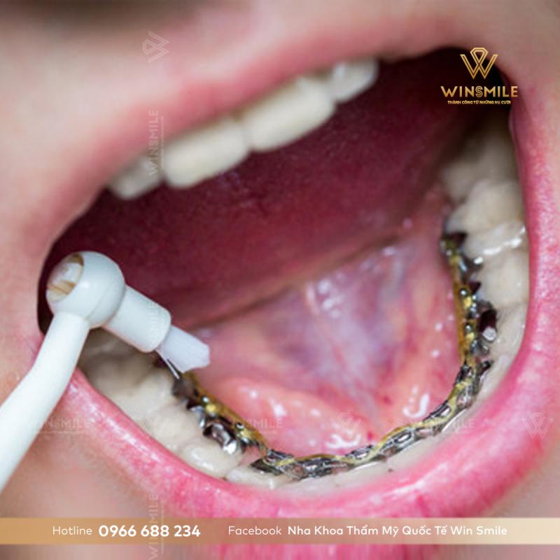 Nha khoa thẩm mỹ quốc tế Win Smile