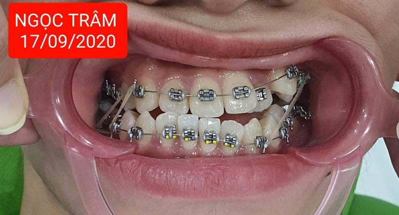 Nha Khoa Thẩm Mỹ Thanh Tú