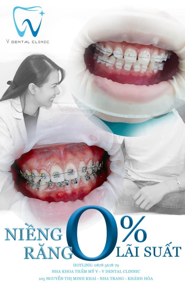 Nha Khoa Thẩm Mỹ V - V Dental Clinic