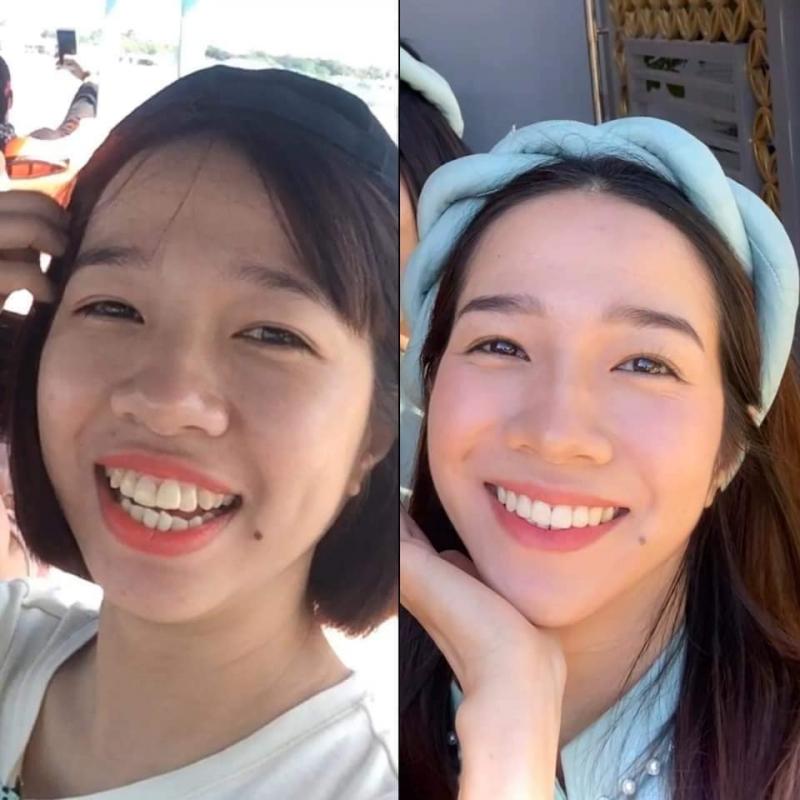 Nha Khoa Việt Pháp
