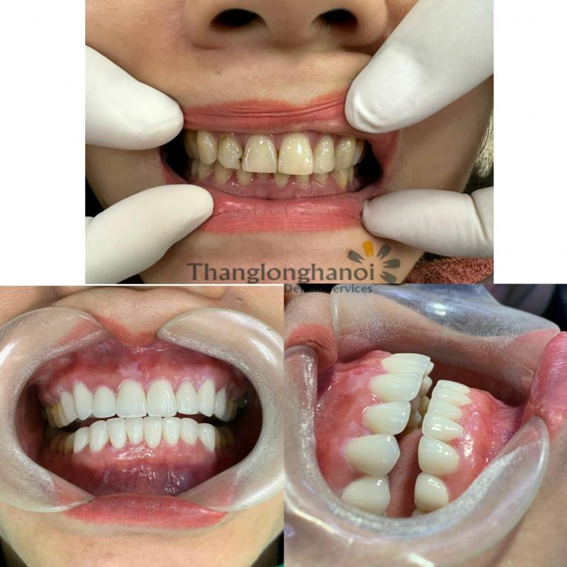 Nha Khoa Thăng Long - Chi Nhánh Đông Anh