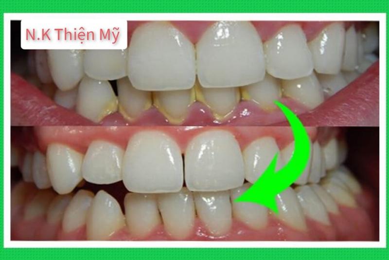 Nha Khoa Thiện Mỹ