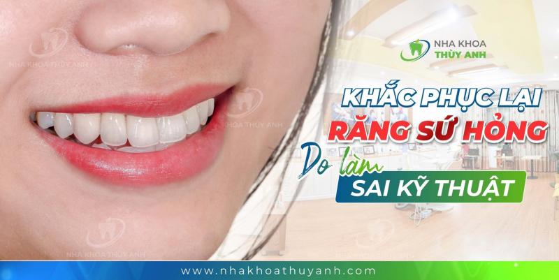 Nha khoa Thùy Anh