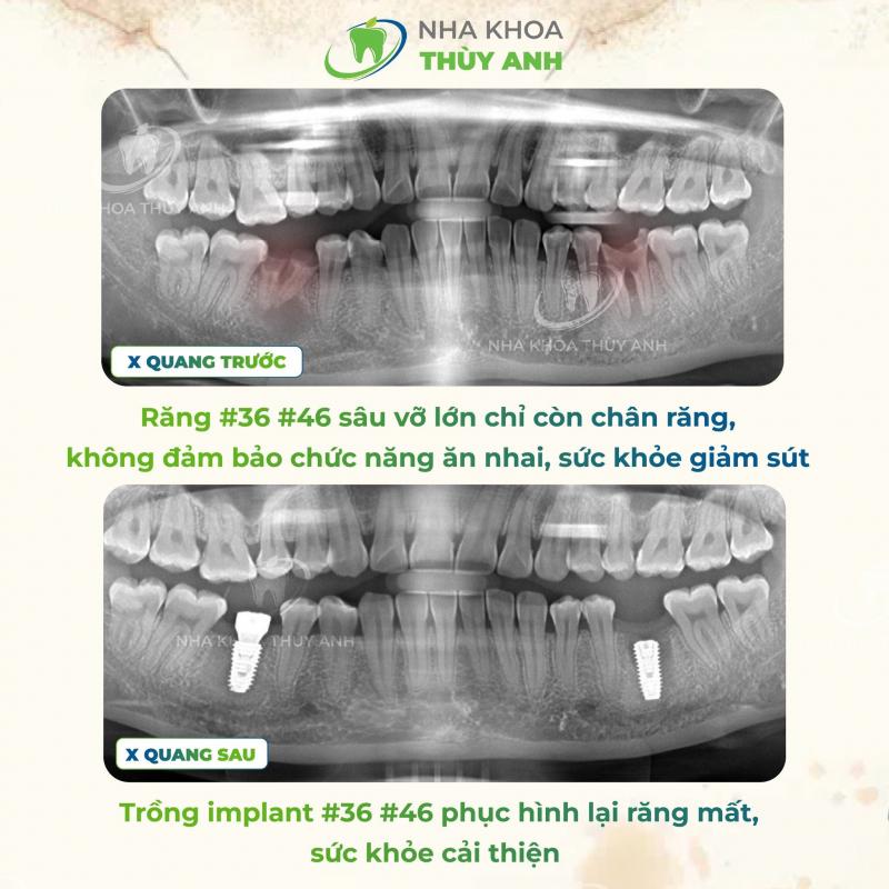 Nha khoa Thùy Anh