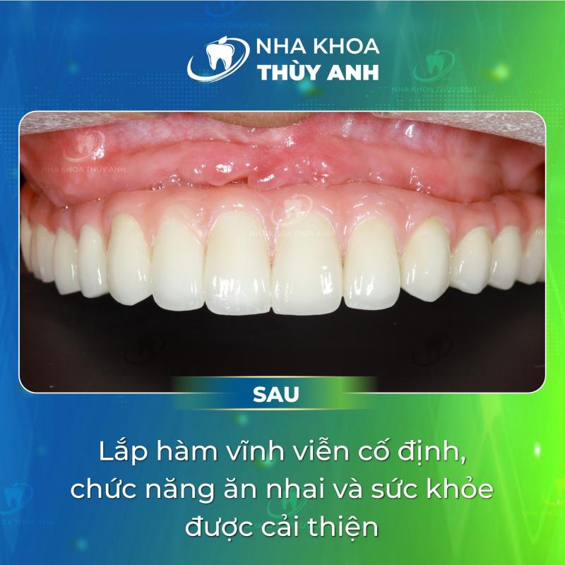 Nha khoa Thùy Anh