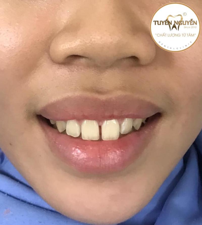 Nha Khoa Tuyến Nguyễn - Tp.Nha Trang