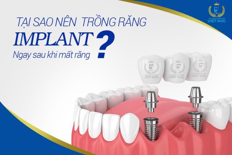 Nha khoa Quốc tế Việt Đức