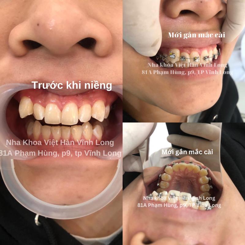 Nha Khoa Việt-Hàn Vĩnh Long