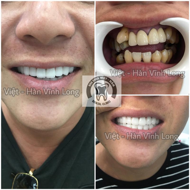 Nha Khoa Việt-Hàn Vĩnh Long