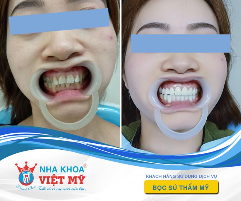 Nha Khoa Việt Mỹ