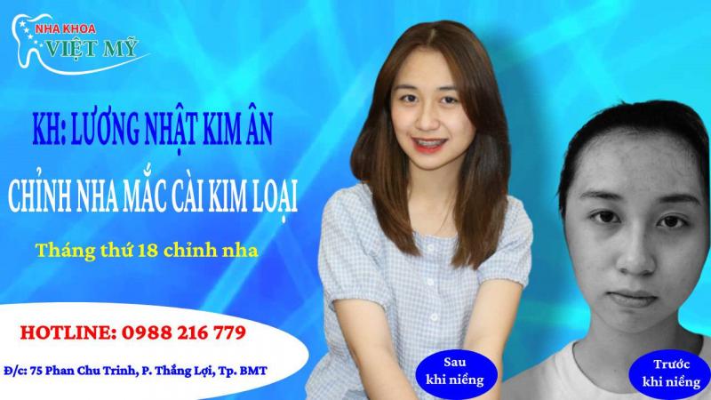 Nha Khoa Việt Mỹ