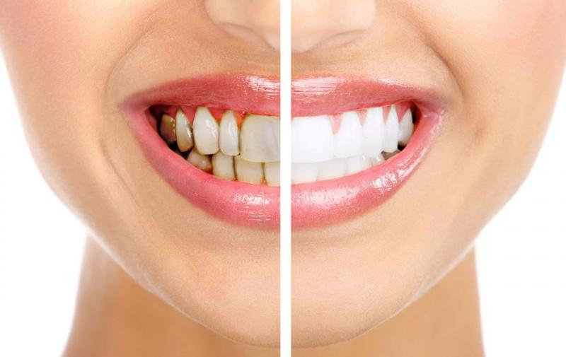 Nha Khoa Việt Mỹ - Quảng Bình
