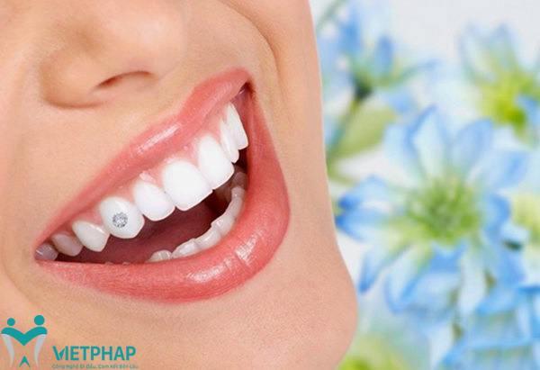 Nha khoa quốc tế Việt Pháp
