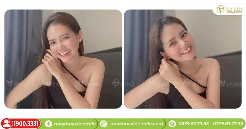 Nha khoa Việt Smile
