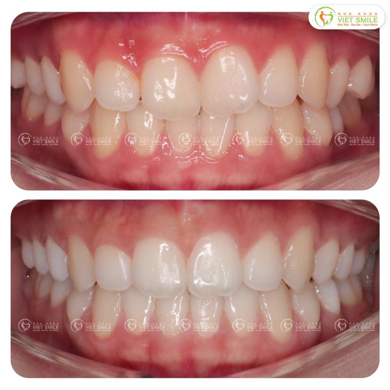 Nha Khoa Viet Smile
