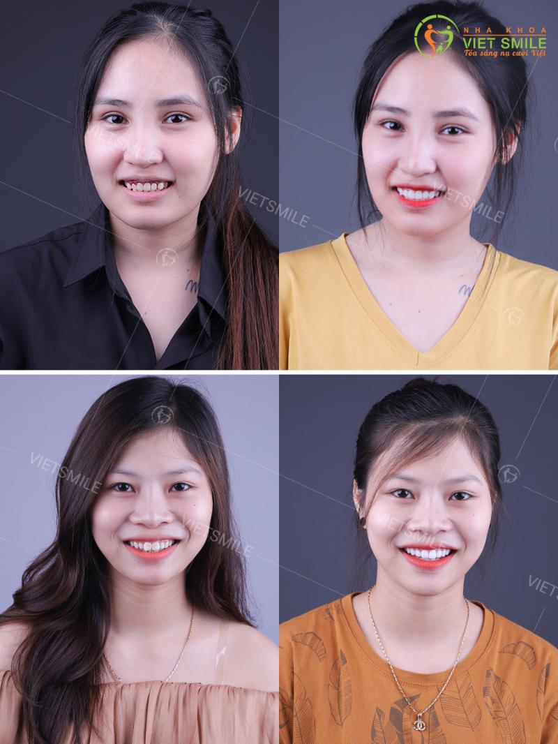Nha khoa VIET SMILE