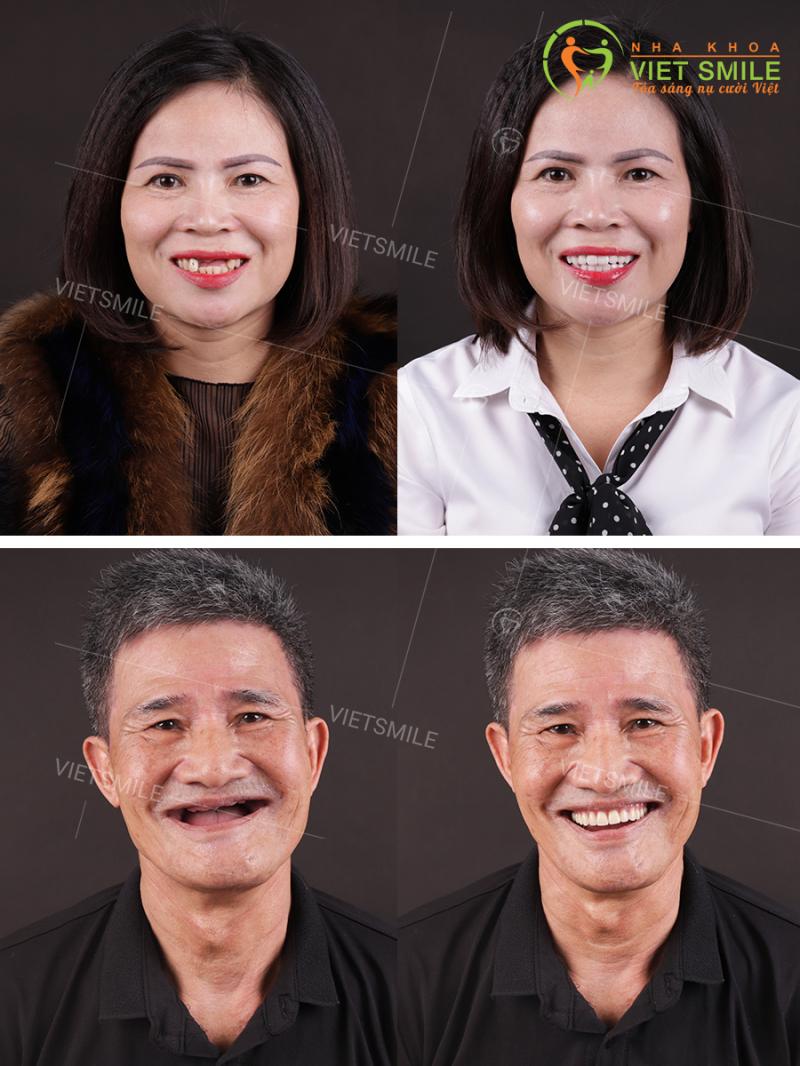 Nha khoa VIET SMILE