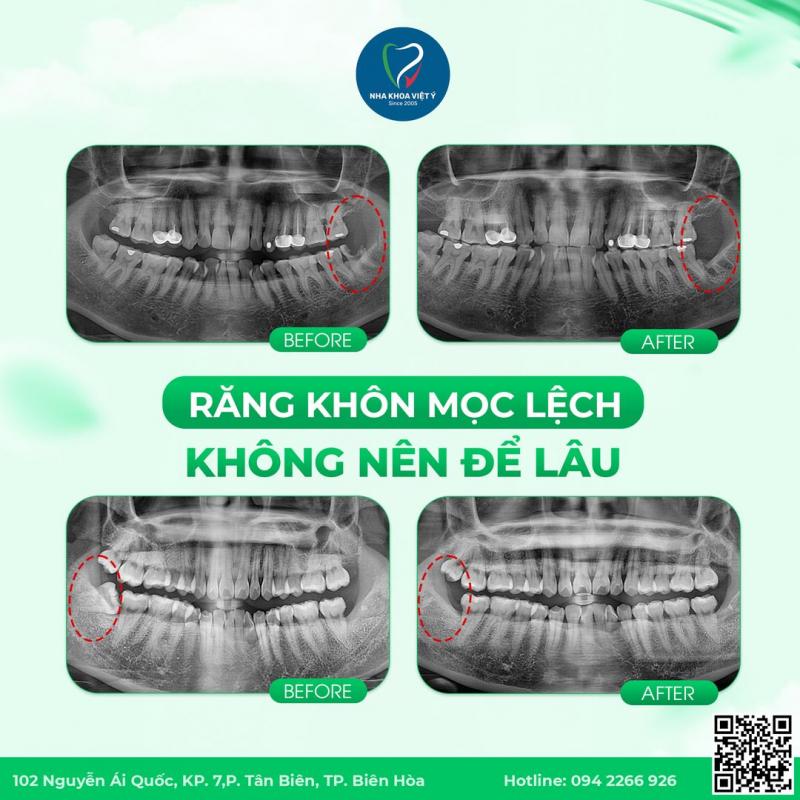 Nha Khoa Việt Ý-Bs Dương và Cộng Sự