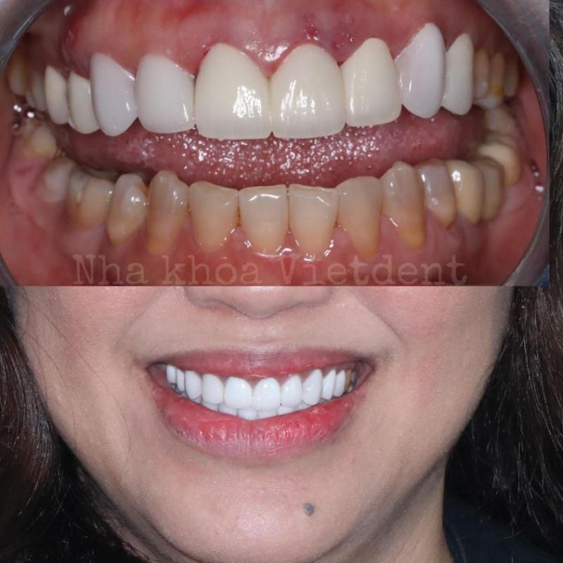 Nha Khoa Vietdent