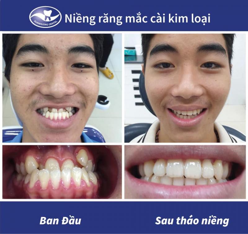 Nha khoa Xuân Hương