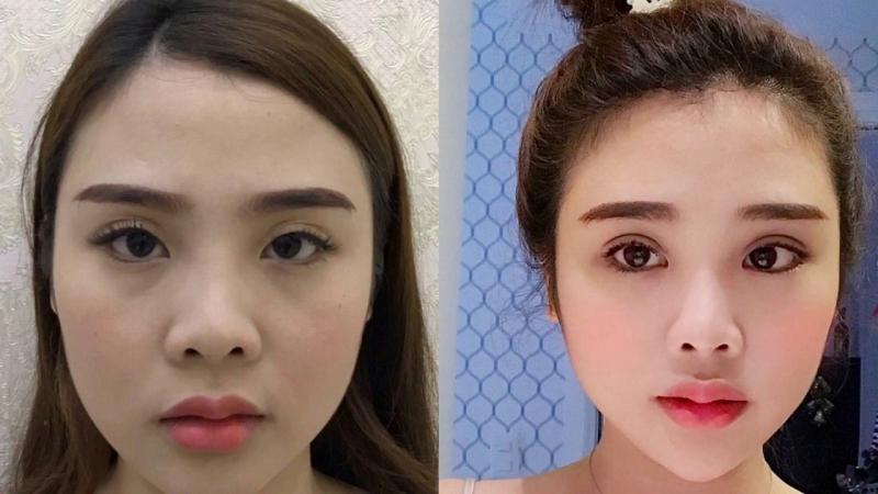 Thẩm mỹ Dr. Duy
