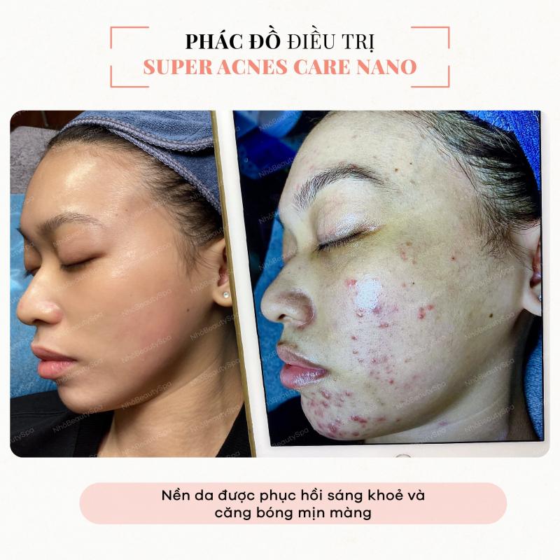 Nhỏ Beauty Spa