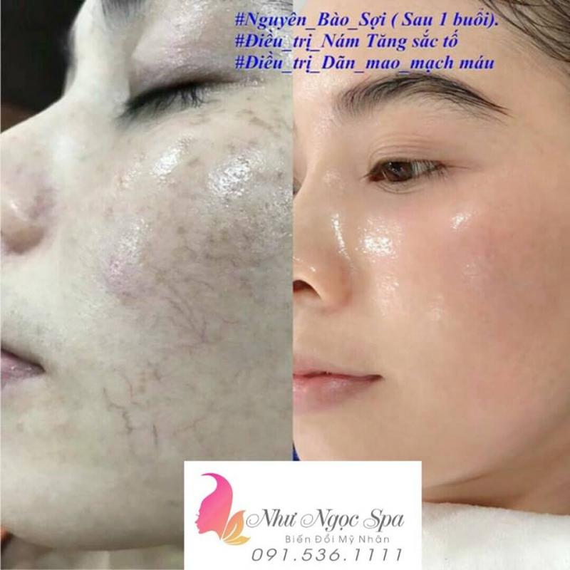 Như Ngọc Spa - Spa Uy Tín Hàng Đầu