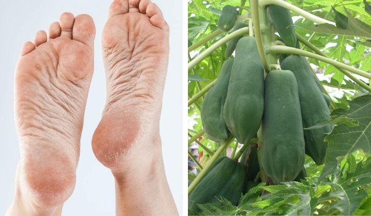 Nhựa đu đủ xanh có tác dụng trị nứt gót chân
