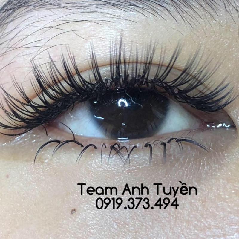 Nối mi Anh Tuyền