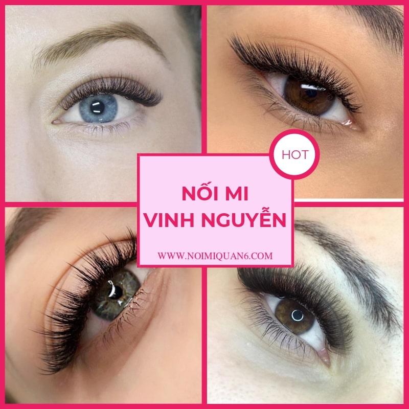 Nối mi Vinh Nguyễn