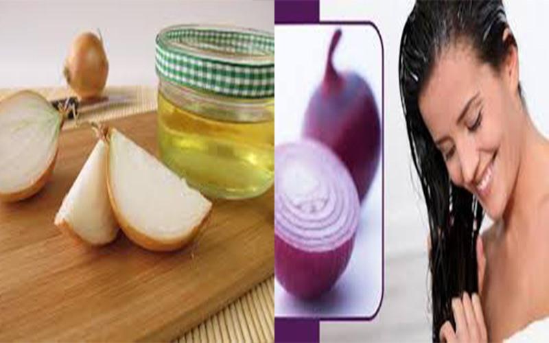Khắc phục rụng tóc tại nhà bằng nước ép hành tây