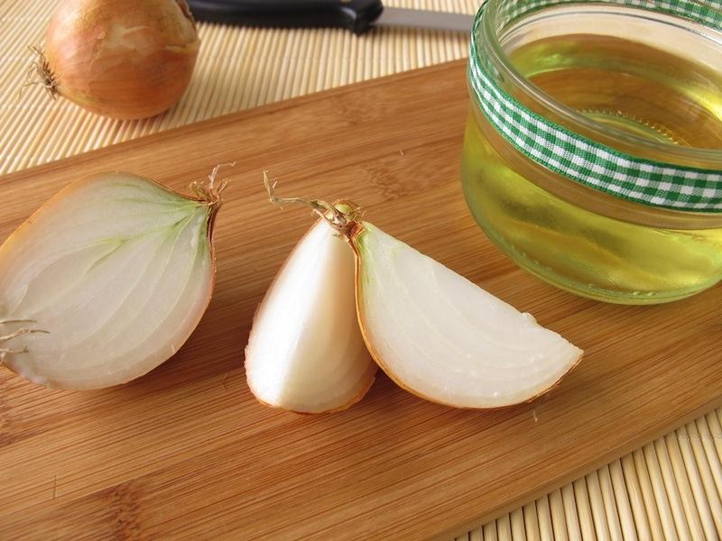 Nước ép hành tây trị rụng tóc