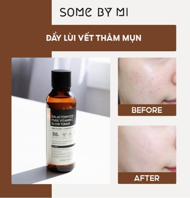 Nước hoa hồng dưỡng trắng, chống lão hóa Some By Mi Galactomyces Pure Vitamin C Glow Toner