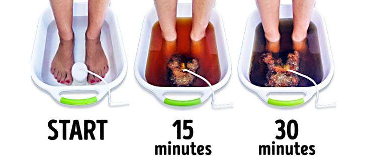 Nước ion thải độc tố