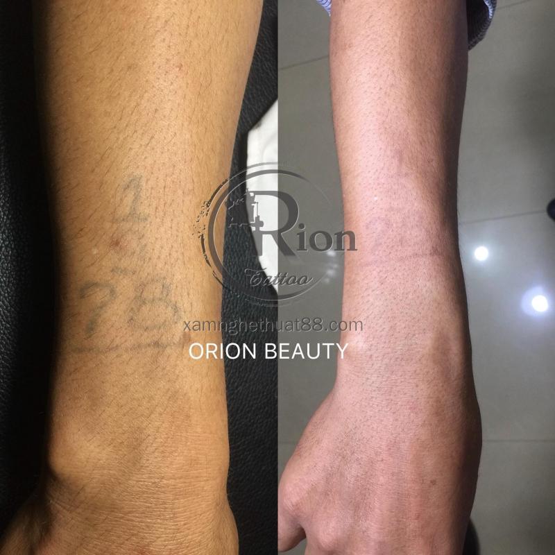 Orion Tattoo