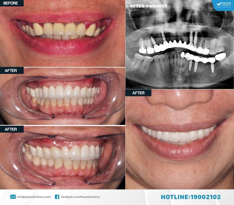 Peace Dentistry
