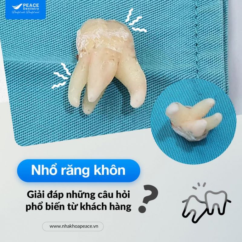 Peace Dentistry