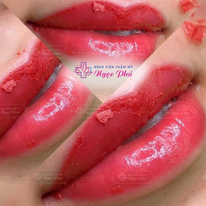 Phẫu Thuật Thẩm Mỹ Ngọc Phú
