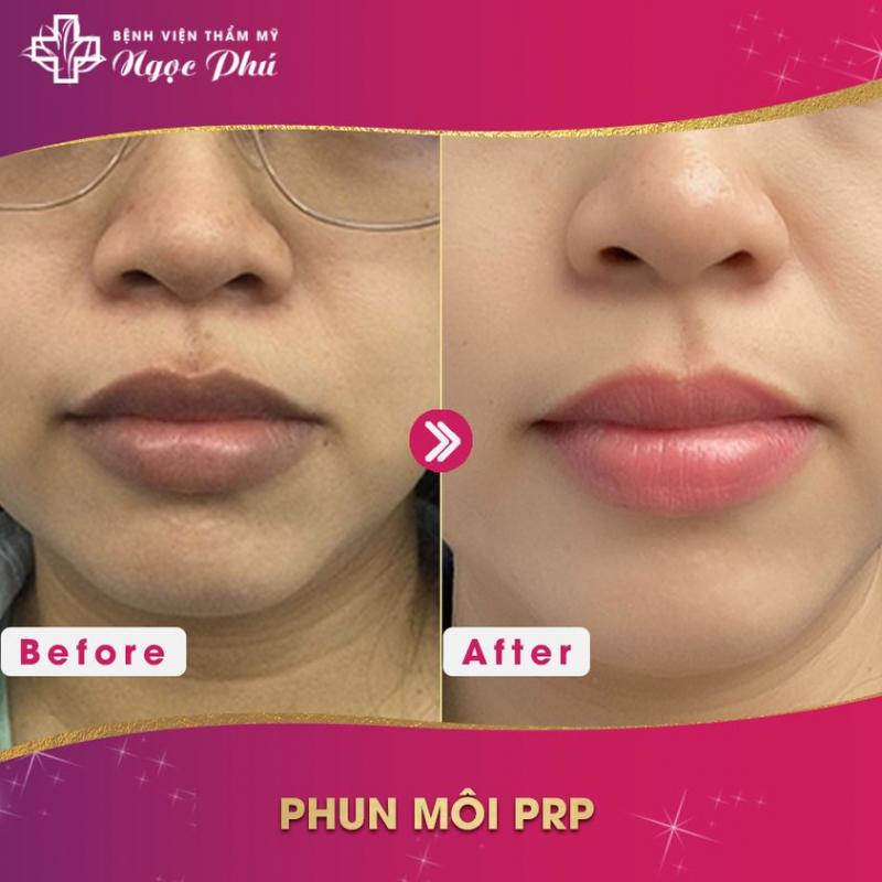 Phẫu Thuật Thẩm Mỹ Ngọc Phú